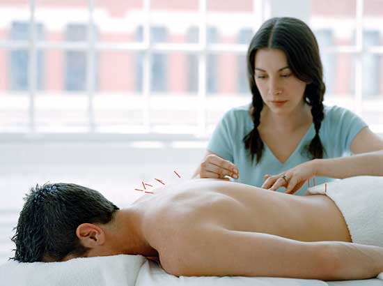 Acupuncture Oakville Ontario